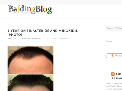 baldingblog.com.png