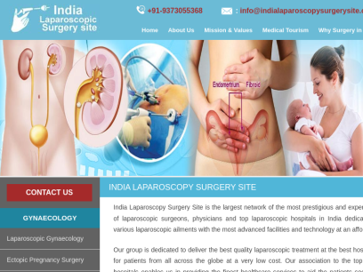 indialaparoscopysurgerysite.com.png