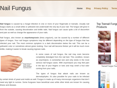 nail-fungus.net.png