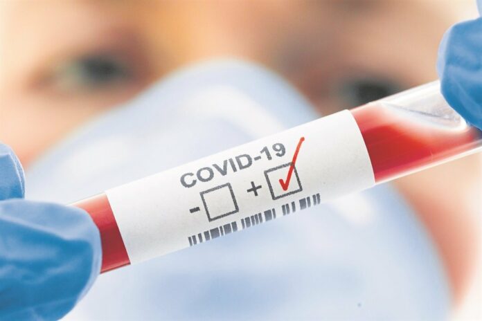 Covid-19 deaths in SA: Most people suffered from comorbidities | News24