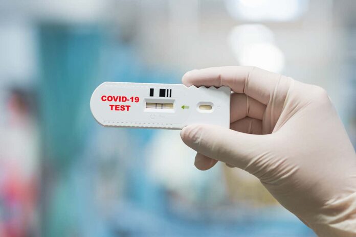 Should you pay for a coronavirus test? Here’s what you need to know
