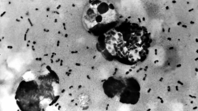 Case of human plague identified in Navajo County