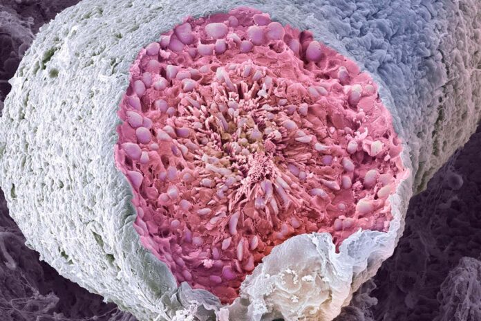 Lab-grown sperm could let infertile men have gene-edited children