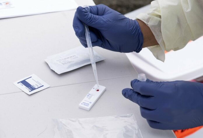 Western Cape to start Covid-19 antibody testing soon | News24