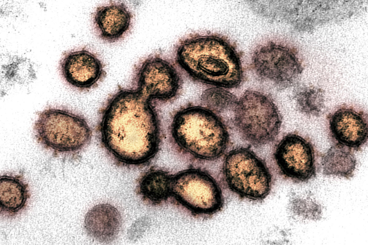 Newly discovered coronavirus mutation could threaten vaccine race, study says