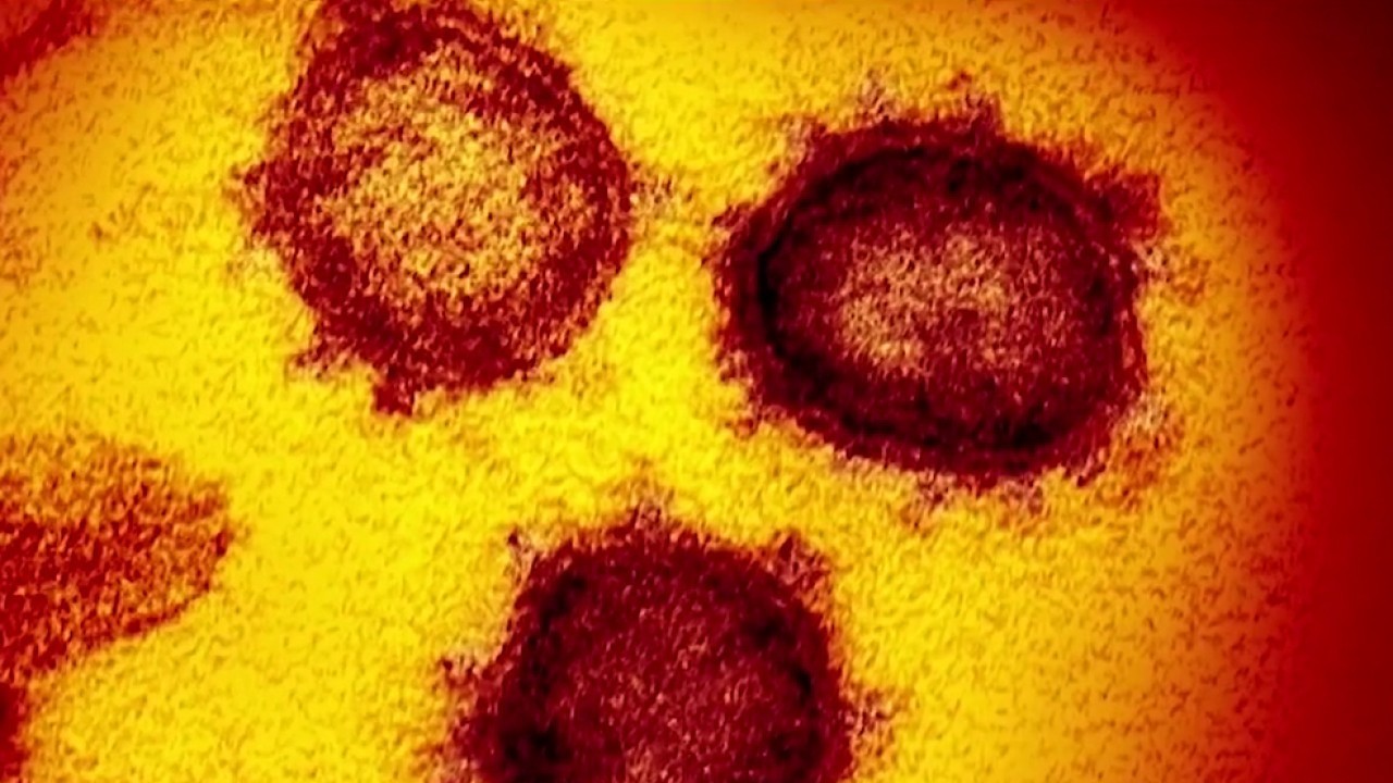 Coronavirus live blog: WebMD Chief Medical Officer Dr. John Whyte answers your concerns