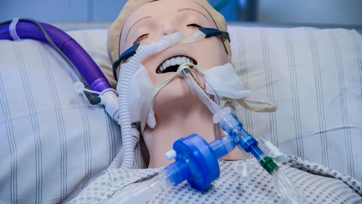 Doctors think ventilators may harm some COVID-19 clients