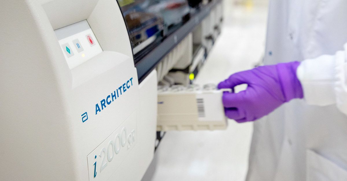 Abbott Labs to ship 4M coronavirus antibody tests this month
