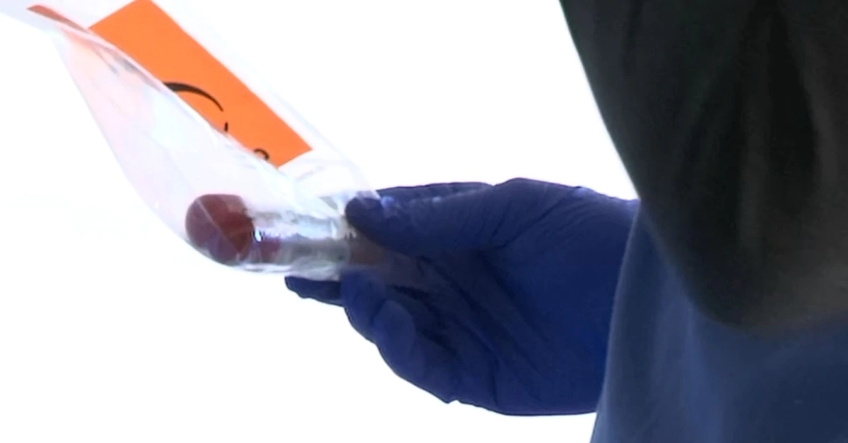 UW recalls faulty coronavirus test kits