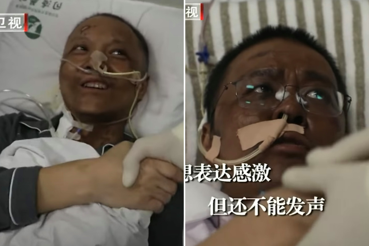 Chinese medical professionals’ skin turns dark after coronavirus recovery