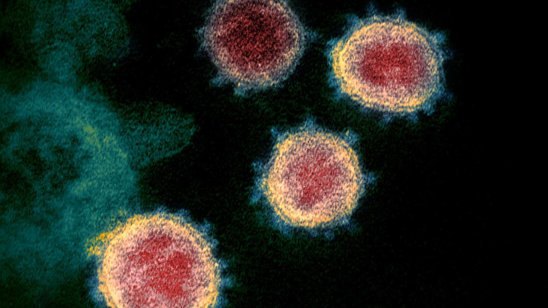 Upgraded: First death from coronavirus reported in Woodbury County