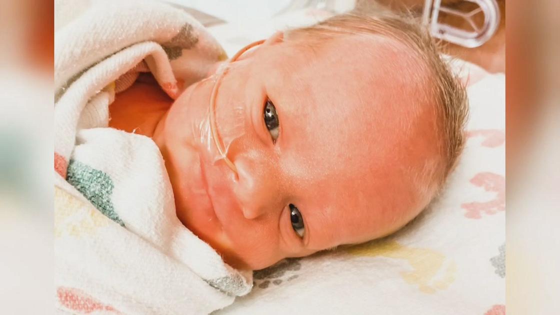 Woman with coronavirus gives birth to a daughter while in a medically induced coma