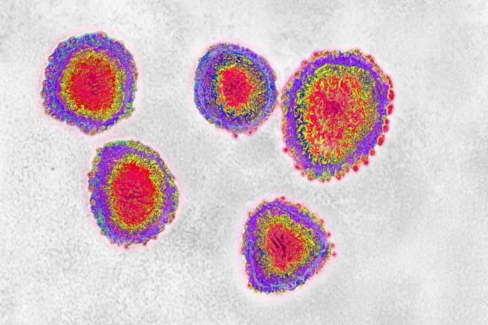 COVID-19 testing: TPG’s Brian Kelly got a second coronavirus antibody test with very different results