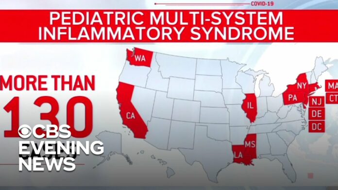 Over 130 kids hospitalized nationwide with conditions related to coronavirus