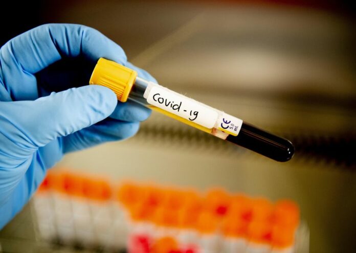Researchers try to solve the mystery of COVID-19 ‘storm of blood clots’