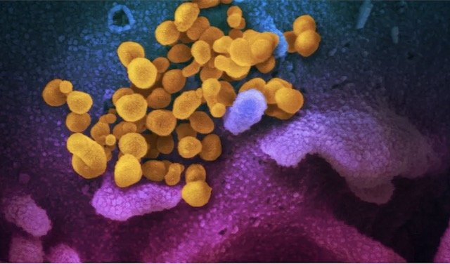 Antimicrobial surface coating kills coronavirus for 90 days: study