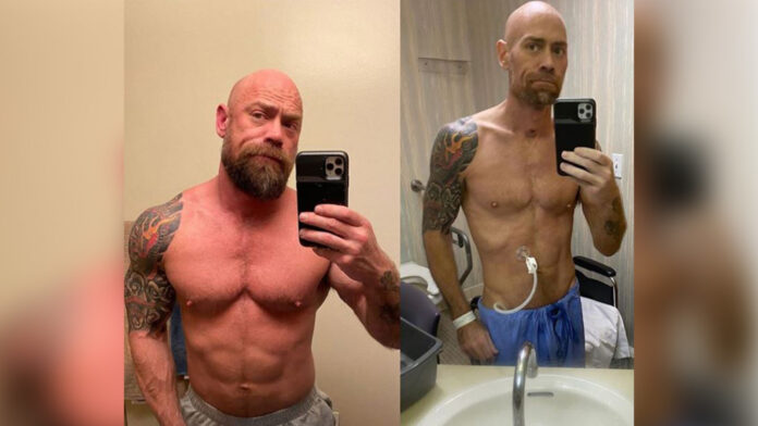 Nurse battling COVID-19 shares his shocking before-and-after weight-loss photos -TV