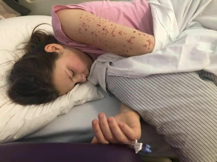 Shocking photo shows ‘energetic’ 13-year-old battling ‘inflammatory disorder from coronavirus’