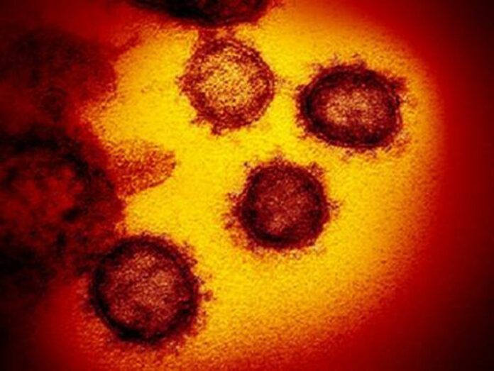 Revised CDC guidance: Coronavirus travels more through crowded spaces than dirty surfaces