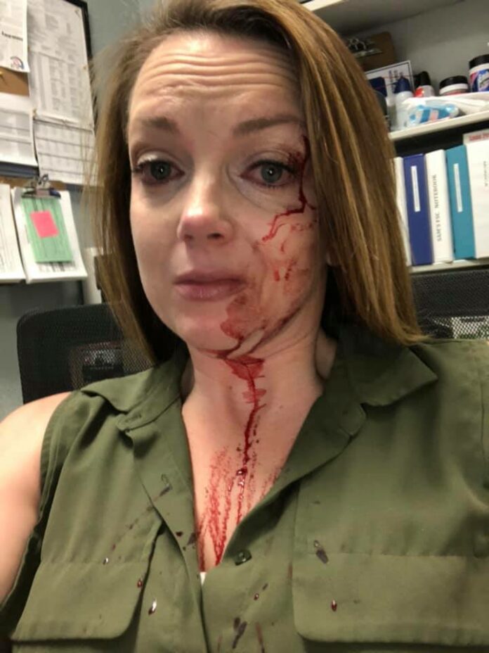 California retail employee posts photo of her bloody face after alleged customer attack