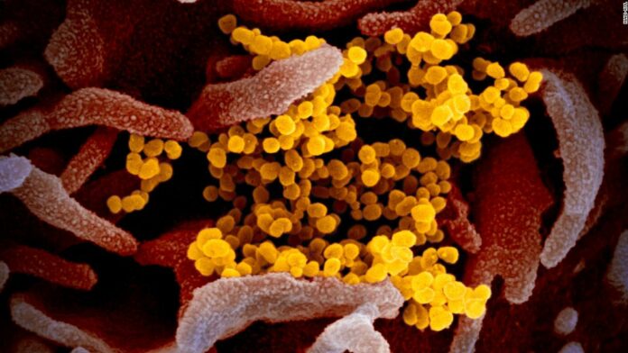 Coronavirus pandemic updates from around the world