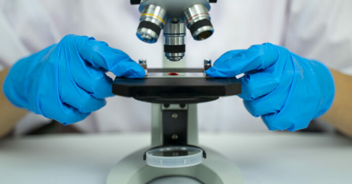 COVID-19: ‘I’ve never seen such sticky blood’ says thrombosis expert