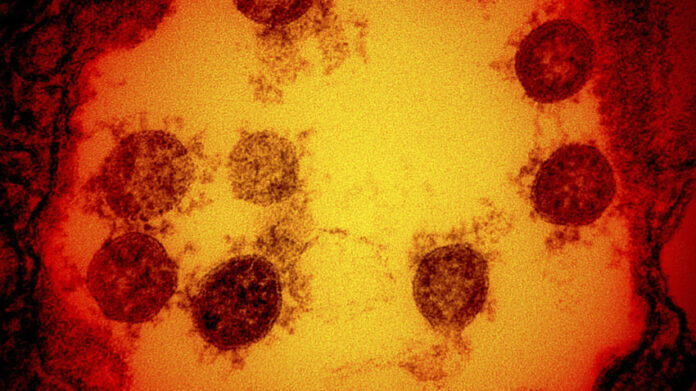 When did the coronavirus start spreading in the U.S.? Likely in January, CDC analysis suggests