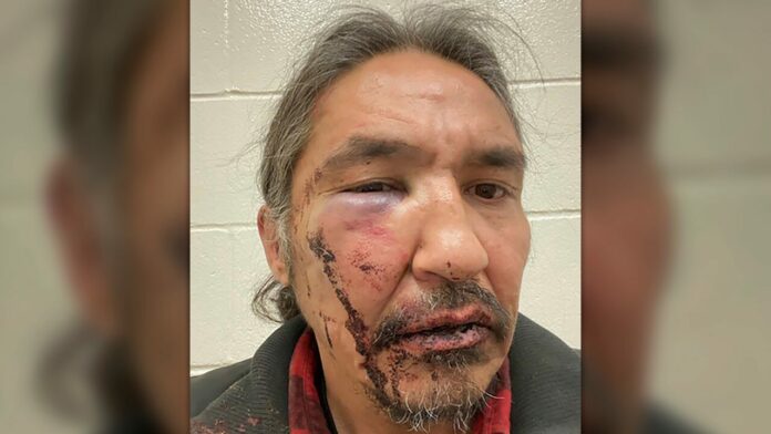 Canada shocked over police video of indigenous chief’s violent arrest