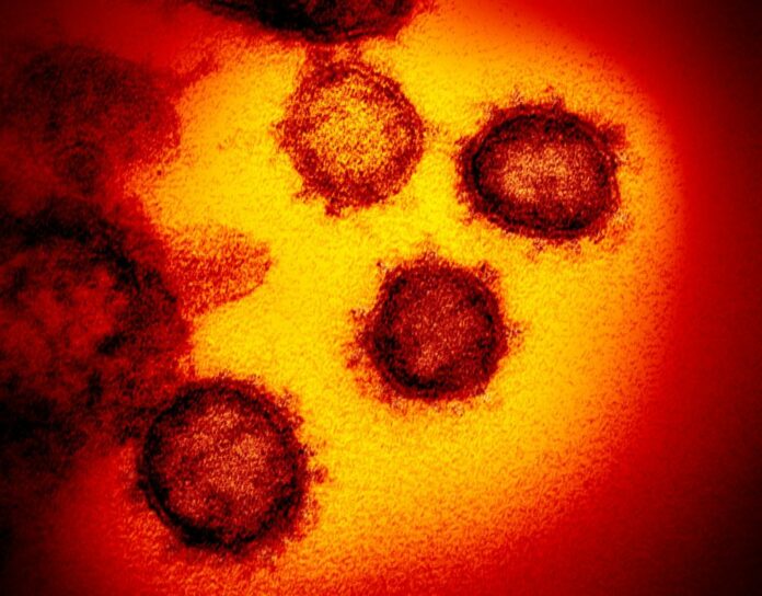 coronavirus-8-things-we-got-wrong-at-first-about-the-deadly-pandemic.jpg Coronavirus: 8 things we got wrong — at first — about the deadly pandemic