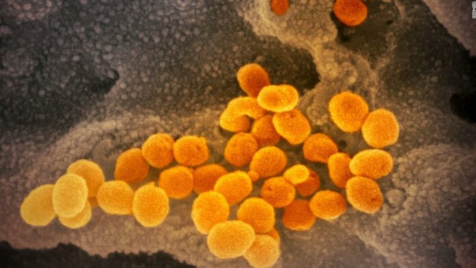 Coronavirus pandemic: The latest updates from around the world