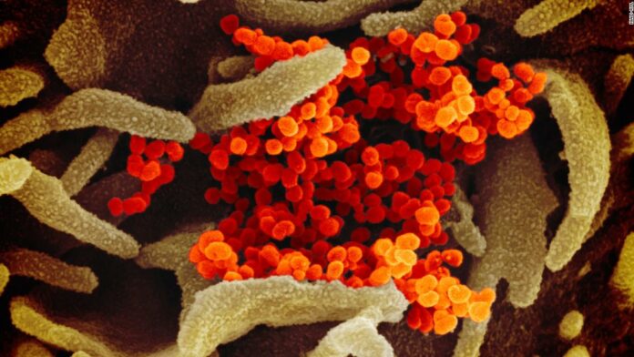 Coronavirus pandemic: Updates from around the world