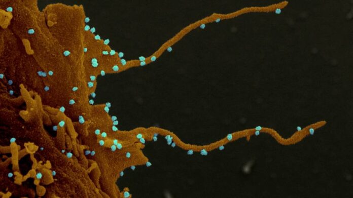 Coronavirus produces ‘sinister’ tentacles in infected cells