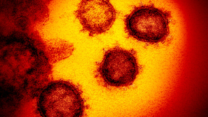 covid-19-outbreak-tears-through-canby-senior-rehab-facility.jpg COVID-19 outbreak tears through Canby senior rehab facility