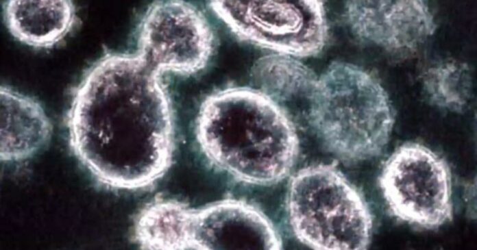 Experts suggest improving ventilation may reduce coronavirus spread