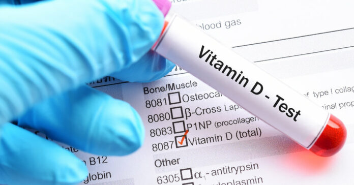 Exploring the Links Between Coronavirus and Vitamin D