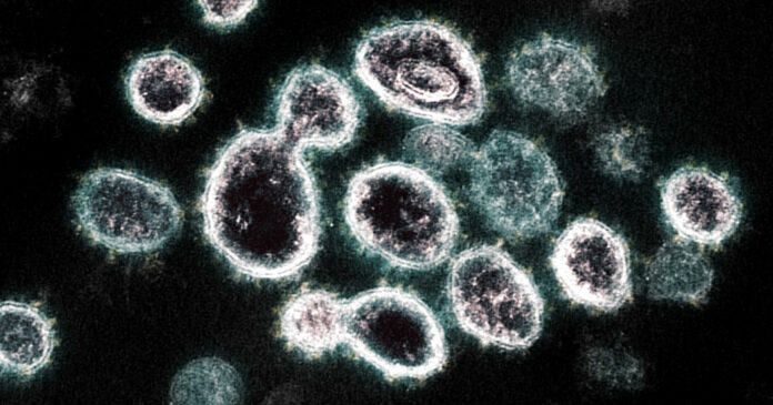 How the Coronavirus Short-Circuits the Immune System