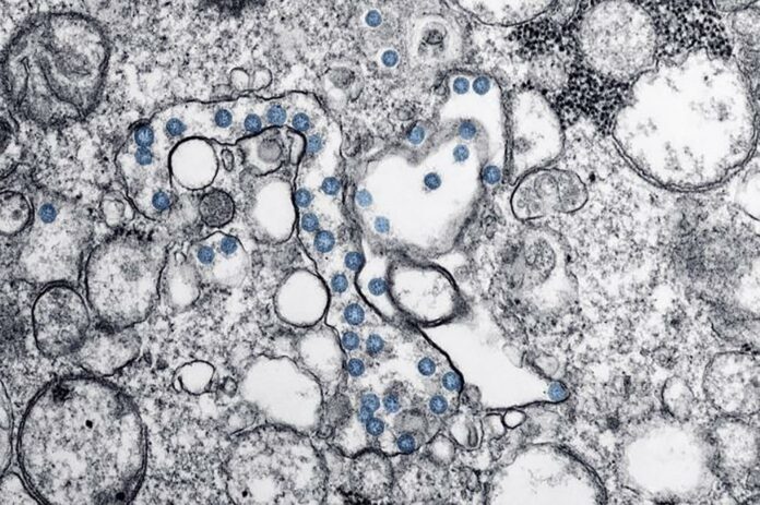Laredo passes 800 coronavirus cases after another record day, announces 22nd death