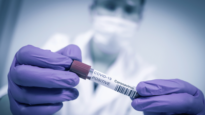 Bend memory care facility reports coronavirus outbreak