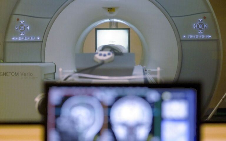 Brain problems linked to even mild coronavirus infections, UK study finds