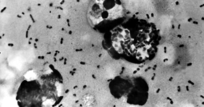 China reports case of suspected bubonic plague in Inner Mongolia