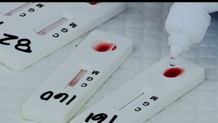 Coronavirus antibodies fade fast but protection may last, study shows