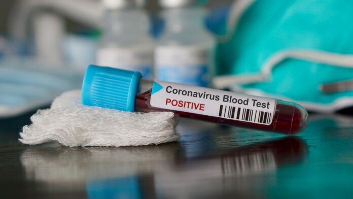 Coronavirus: Ventura County’s positive test rate climbs past state threshold