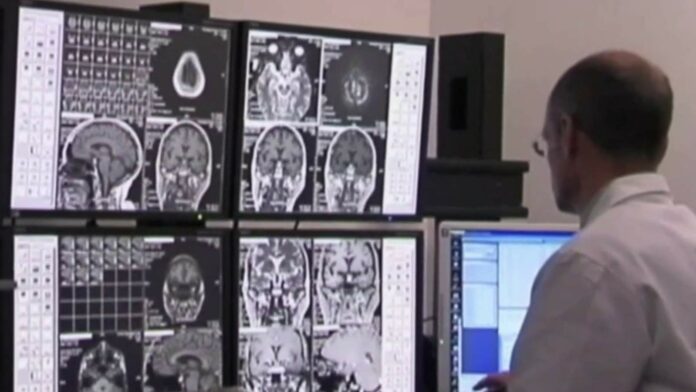 COVID-19 deaths in early months of pandemic might have been underestimated by nearly 30%, study says