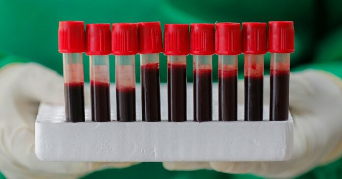 Does Blood Type Affect Your Risk Of Coronavirus? Probably Not, New Studies Say