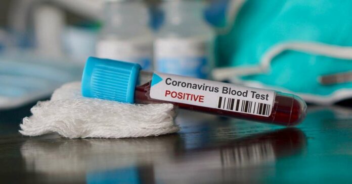 If You Have This in Your Blood, You’re Twice as Likely to Die From COVID