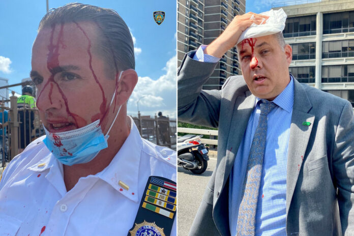 NYPD officials attacked, bloodied at Brooklyn Bridge police-brutality protests
