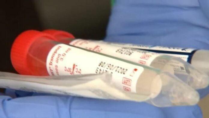 Oregon Health Authority reports 375 new COVID-19 cases, highest daily count since pandemic began