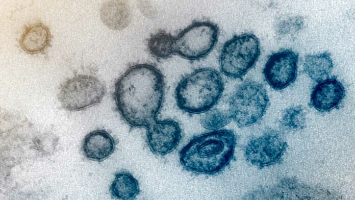 San Joaquin County ICUs at 121% capacity, COVID-19 federal team deployed