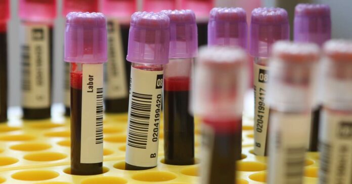Scientists inch closer to blood test to detect early stage cancer