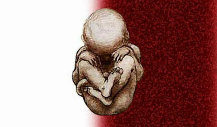 The similarities between slavery and abortion